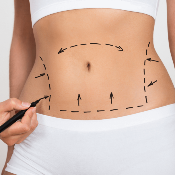 chirurgie esthétique